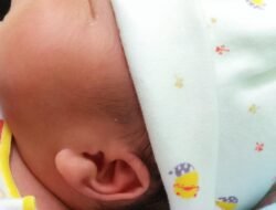 Bayi Unik, Lahir Dengan Lekukan Telinga Menyerupai Lafadz Allah