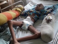 Derita Dian, Bocah 8 Tahun Penderita Tumor Otak dan Gizi Buruk