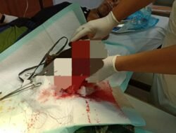 Gurauan Pelecehan Berujung Pembacokan Hingga Tangan Putus