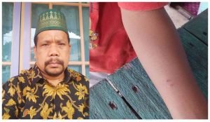 Anak SD Silet Tangan, Puspa: Kepedulian Terhadap Anak Ditingkatkan