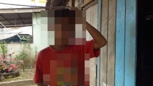 OH Ngaku Dipaksa Kawan Nyilet Tangan