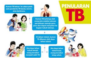 Tuberkulosis di Melingkat Terjadi Sejak 2009