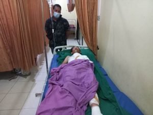 Tersengat Listrik, Sebagian Tubuh Pekerja Bangunan Alami Luka Bakar