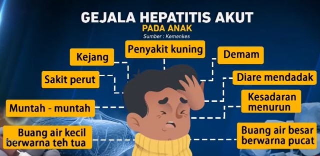 Waspada, Hepatitis Akut Misterius Serang Anak-anak