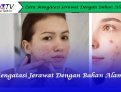 8 Cara Mengatasi Jerawat Dengan Bahan Alami