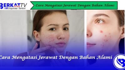 Cara mengatasi jerawat dengan bahan alami