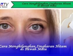 Cara Menghilangkan Lingkaran Hitam di Bawah Mata