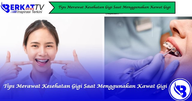 Tips Merawat Kesehatan Gigi Saat Menggunakan Kawat Gigi