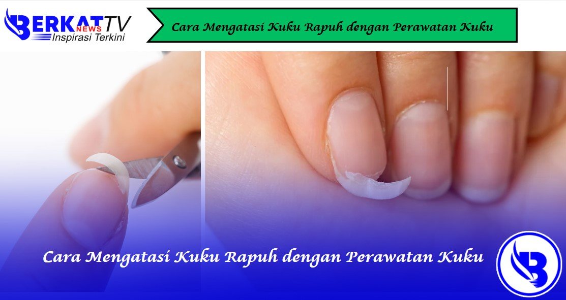 Cara Mengatasi Kuku Rapuh dengan Perawatan Kuku