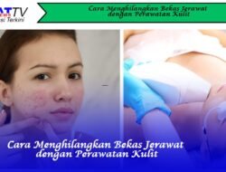 Cara Menghilangkan Bekas Jerawat dengan Perawatan Kulit