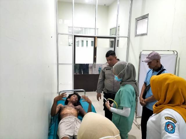 Badan Seteven Melepuh Tersiram Kuah Bakso
