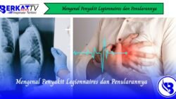 Mengenal Penyakit Legionnaires dan Penularannya
