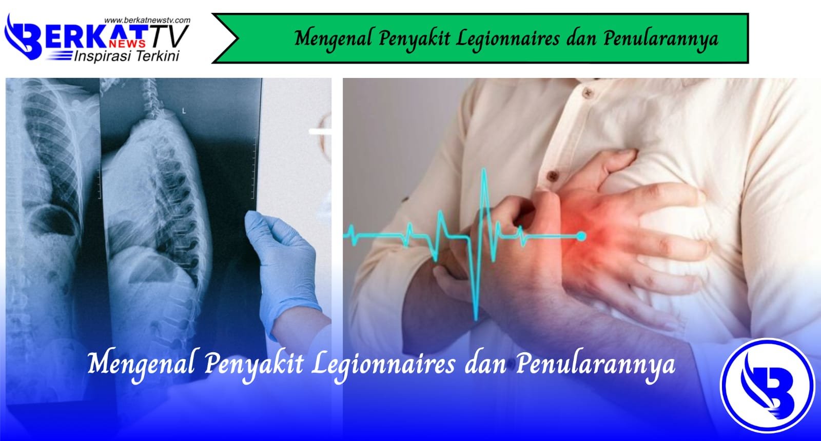 Mengenal Penyakit Legionnaires dan Penularannya