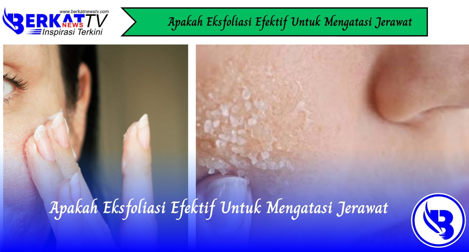 Apakah Eksfoliasi Efektif Untuk Mengatasi Jerawat