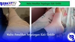 Waktu Pemulihan Pergelangan Kaki Terkilir