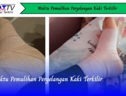 Waktu Pemulihan Pergelangan Kaki Terkilir