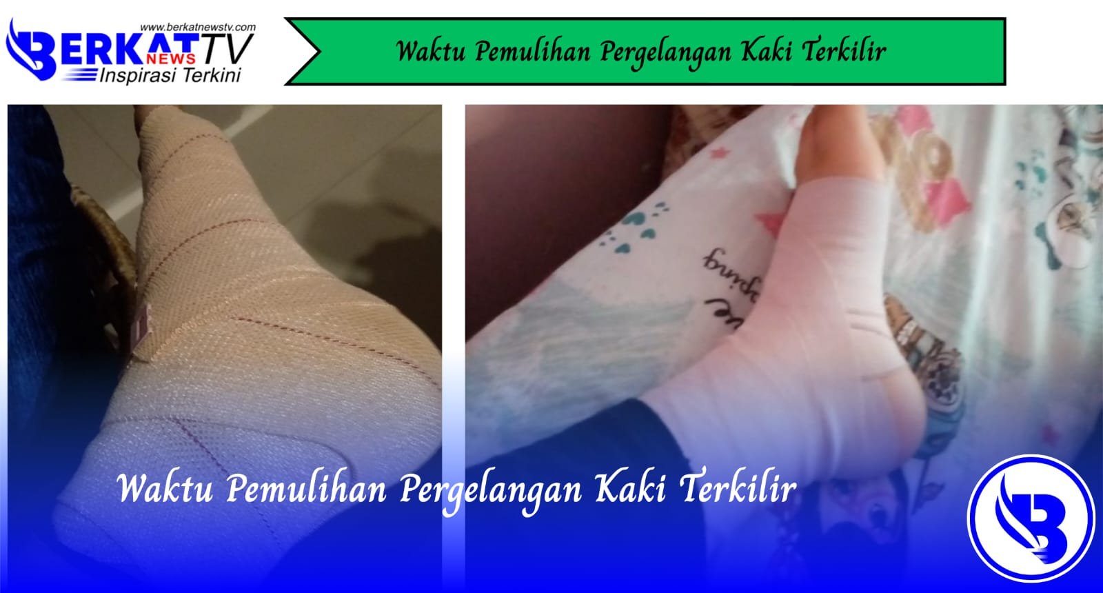 Waktu Pemulihan Pergelangan Kaki Terkilir