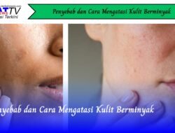 Penyebab dan Cara Mengatasi Kulit Berminyak