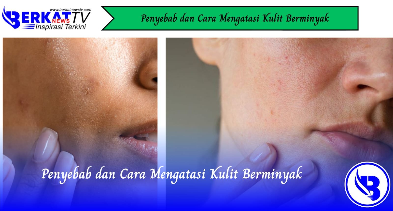 Penyebab dan Cara Mengatasi Kulit Berminyak